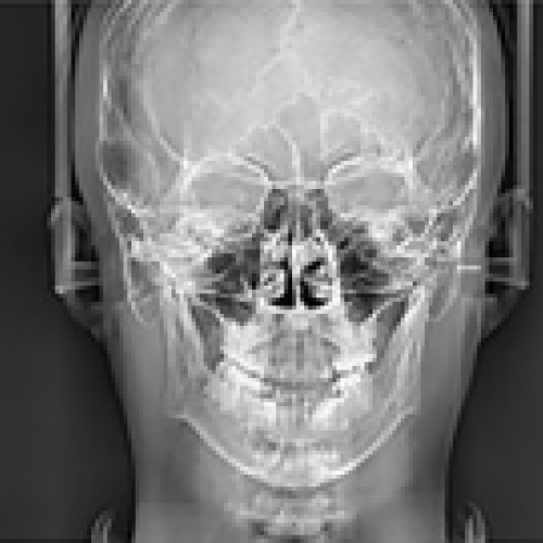 3 pax i3d smart 30