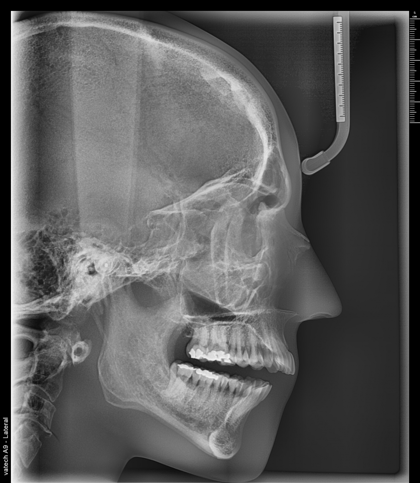 dx20210106 183758 6810 76338464