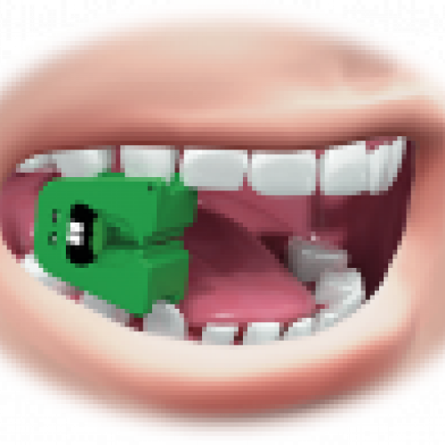 prodsec 562591
