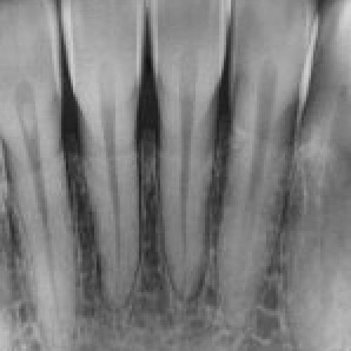 trident i view gold gallery 01 2