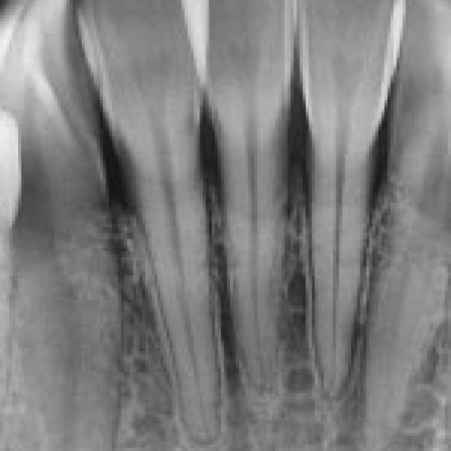 trident i view gold gallery 04 2