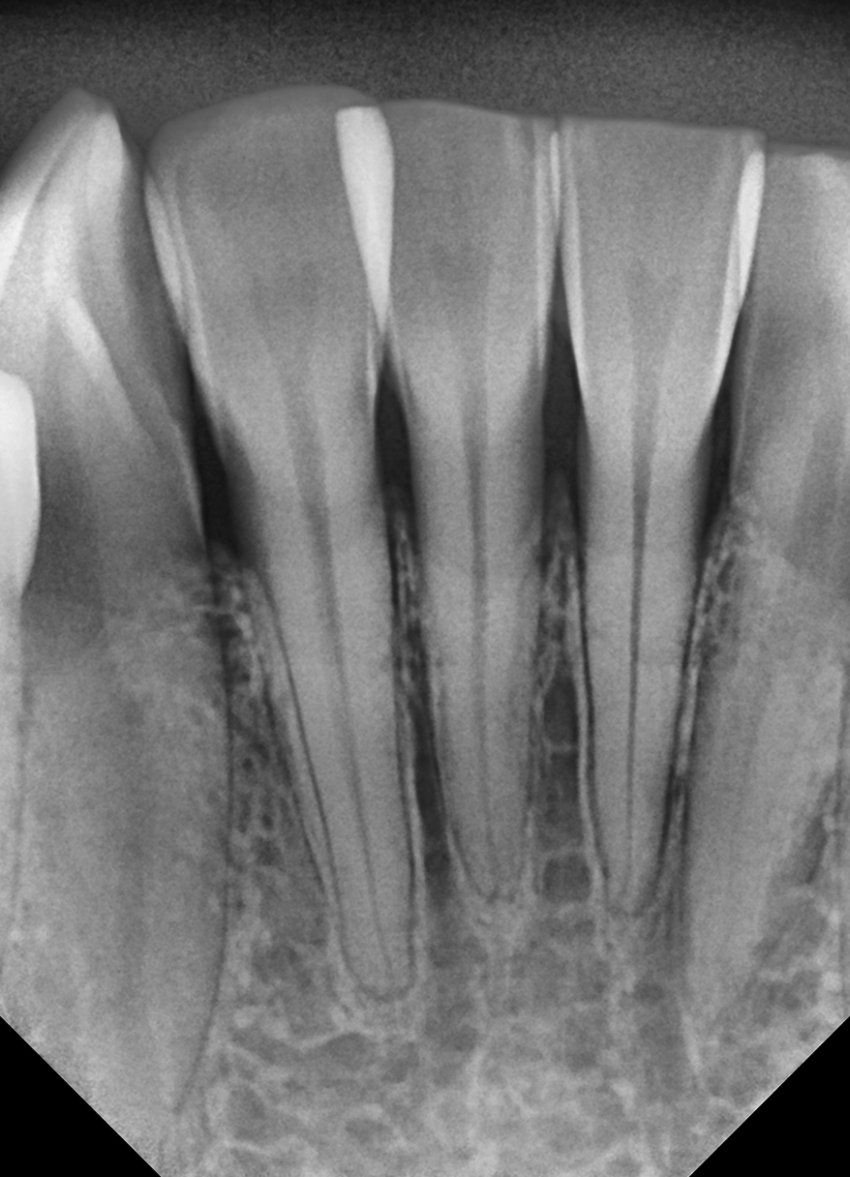 trident i view gold gallery 04 2